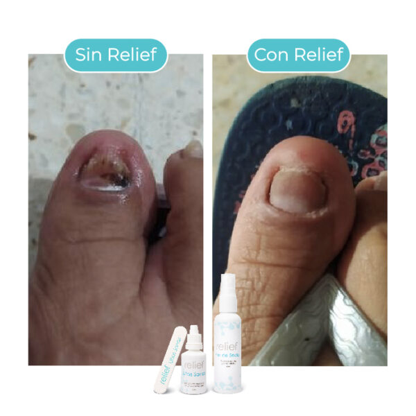 UÑAS SANAS: Gotas para hongos en las uñas - Imagen 7