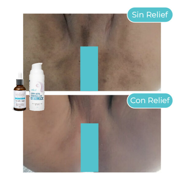 KIT ZONAS INTIMAS: Serum Hidratante y Despigmentante - Imagen 4