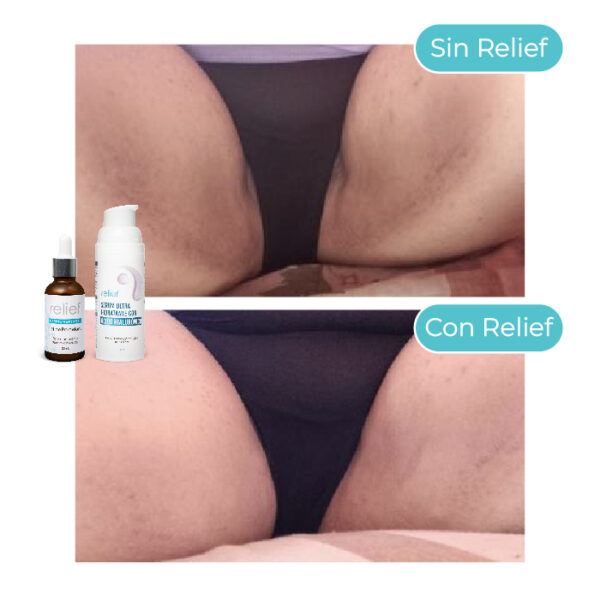 KIT ZONAS INTIMAS: Serum Hidratante y Despigmentante - Imagen 6