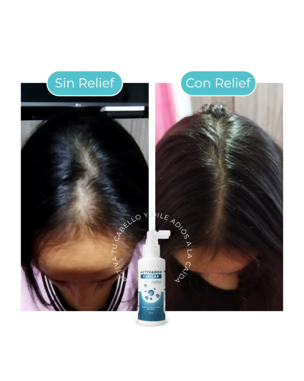ACTIVADOR CAPILAR: para el crecimiento del cabello - Imagen 3