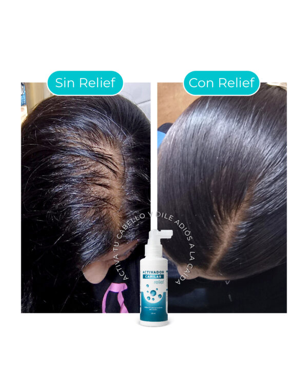 ACTIVADOR CAPILAR: para el crecimiento del cabello - Imagen 5