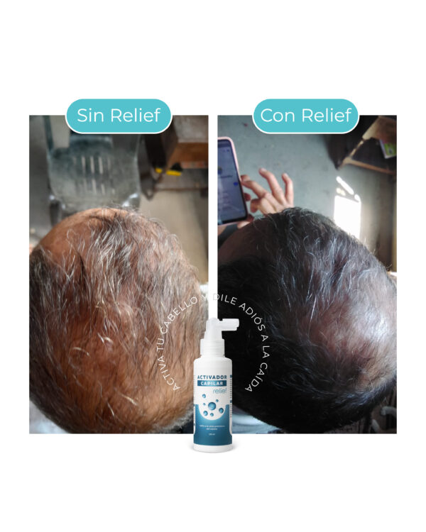ACTIVADOR CAPILAR: para el crecimiento del cabello - Imagen 2